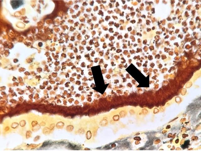 Rodent Cestodiasis liver tapeworms